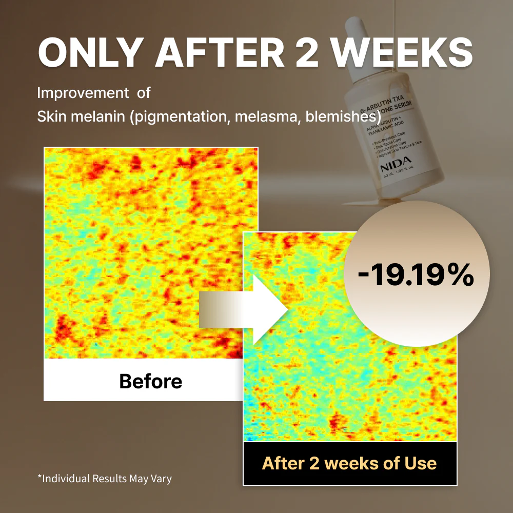 NIDA α-Arbutin TXA Pure Tone Serum - Image 3