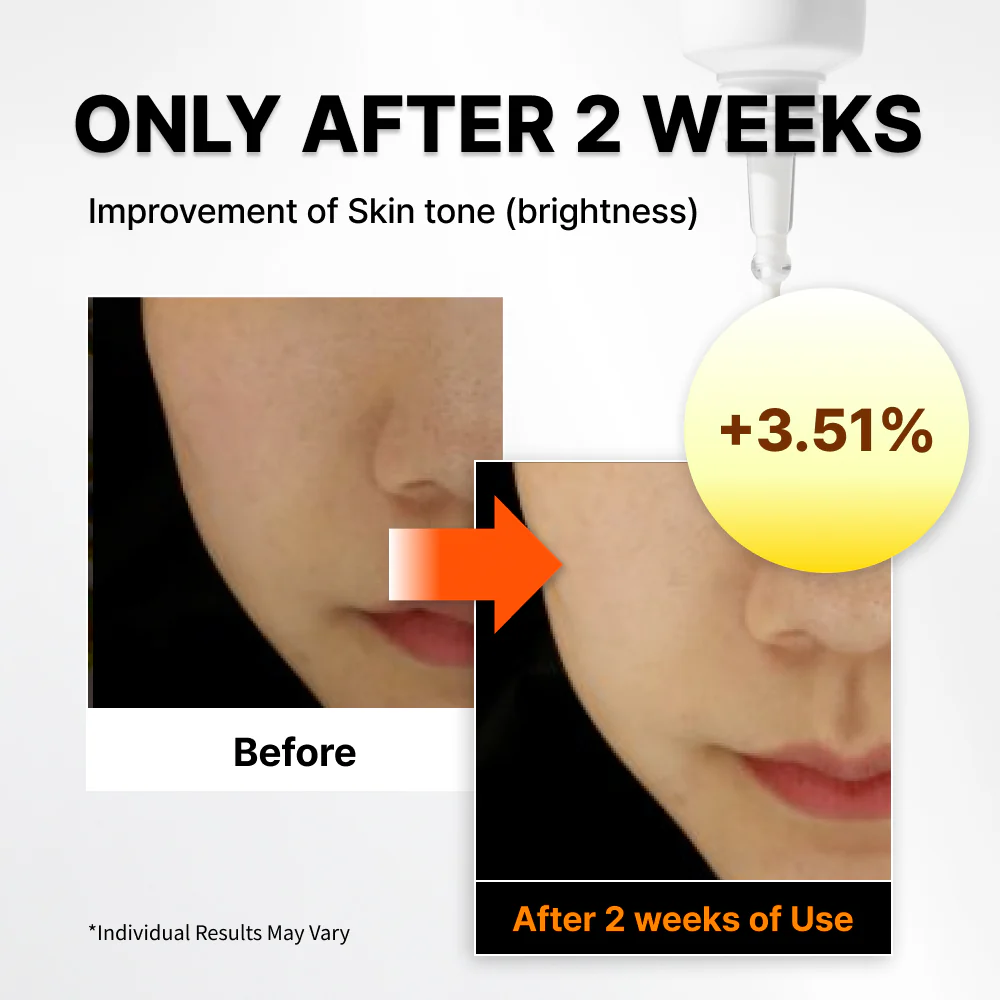 NIDA Invisible Fit Sun Serum for Face - Image 4