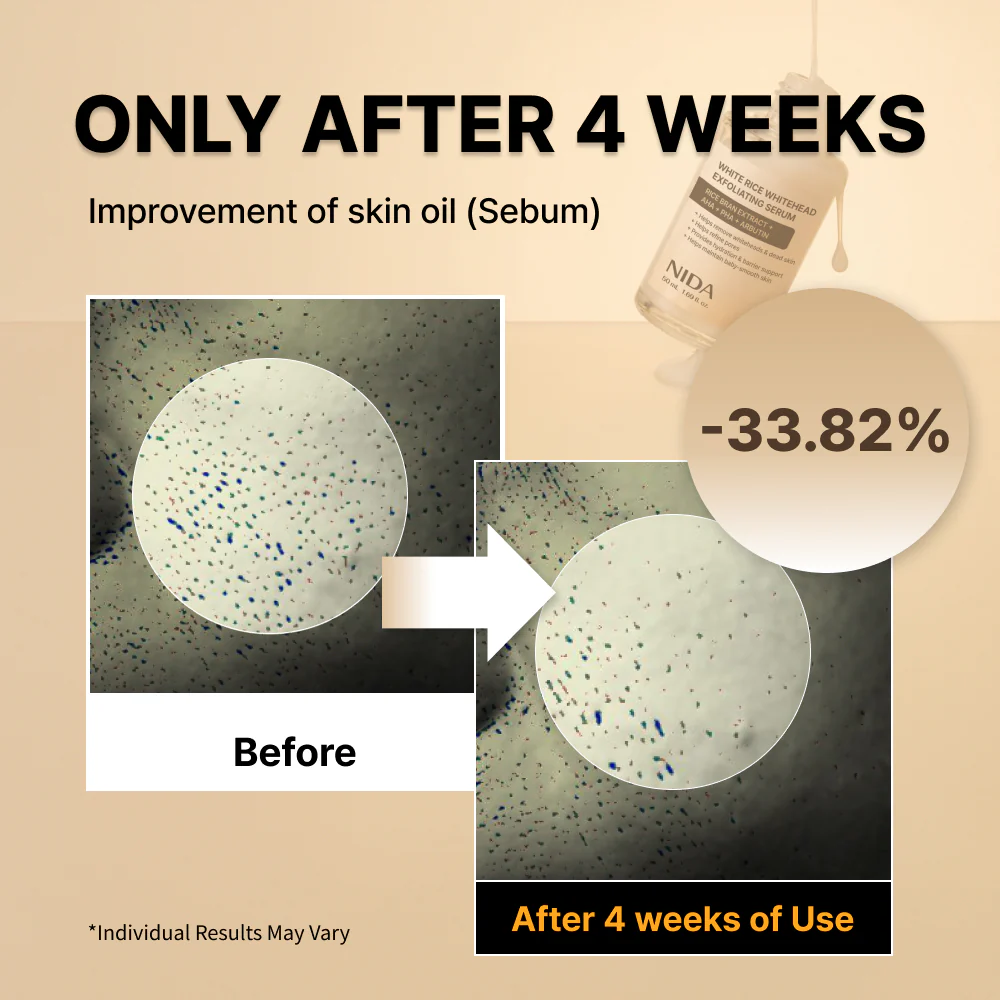 NIDA White Rice Whitehead Exfoliating Serum - Image 5